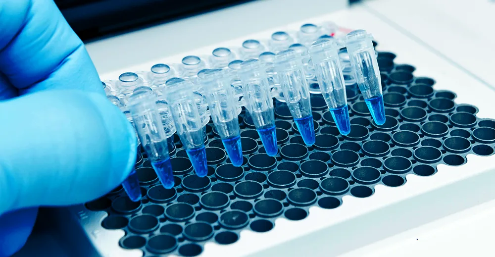 آزمایش مولکولی PCR پرندگندر آزمایشگاه